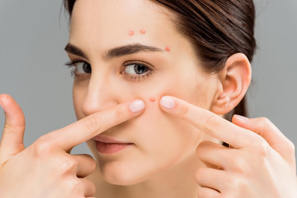 que hacer contra el acné femenino