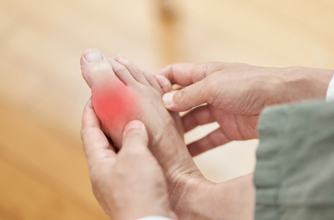 remedios naturales para la artritis